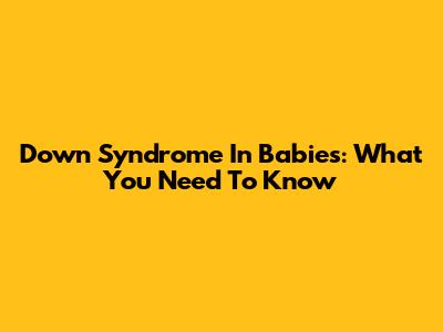 Down Syndrome In Babies: What You Need To Know