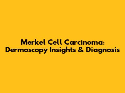 Merkel Cell Carcinoma: Dermoscopy Insights & Diagnosis
